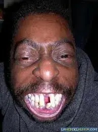 feo 2.webp feo 2.webp